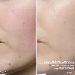 Best SOS Calming Ampoule Concentrates 14 ml Serum