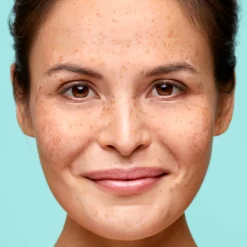 Gelcrème Vette & Gemengde Huid 50 ml^Biodermal Best