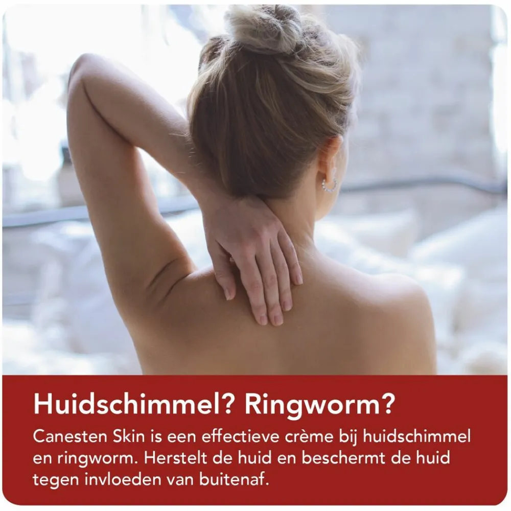 Huid<Canesten Skin Crème bij Huidschimmel 30 gr