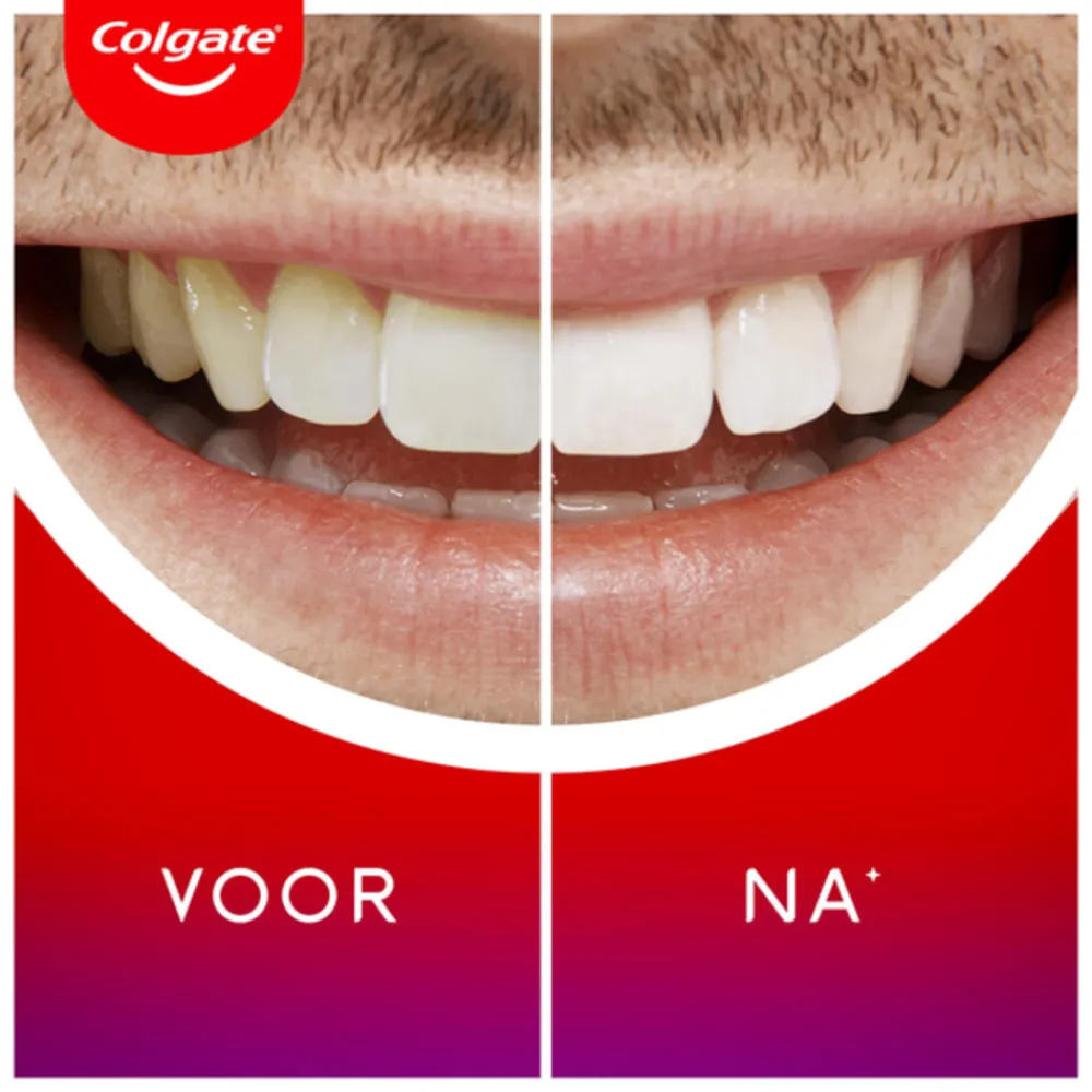 Specialistische Mondverzorging<Colgate Max White Overnight Tanden Whitening Serum 2,5 ml