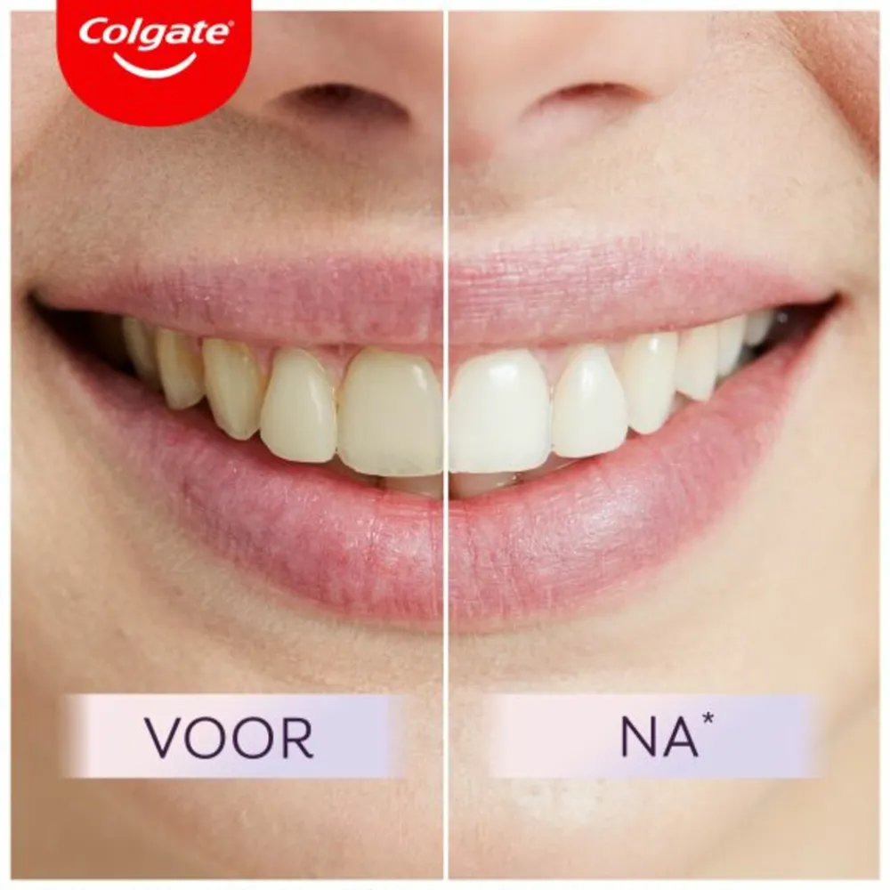 Spoelen & Poetsen<Colgate Tandpasta Max White Ultimate 75 ml