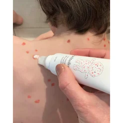 Gezondheidsproducten<Donttellmum Waterpokken Behandeling 50 ml