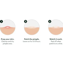 Reiniging<Hero Cosmetics Mighty Patch The Original 24 stuks