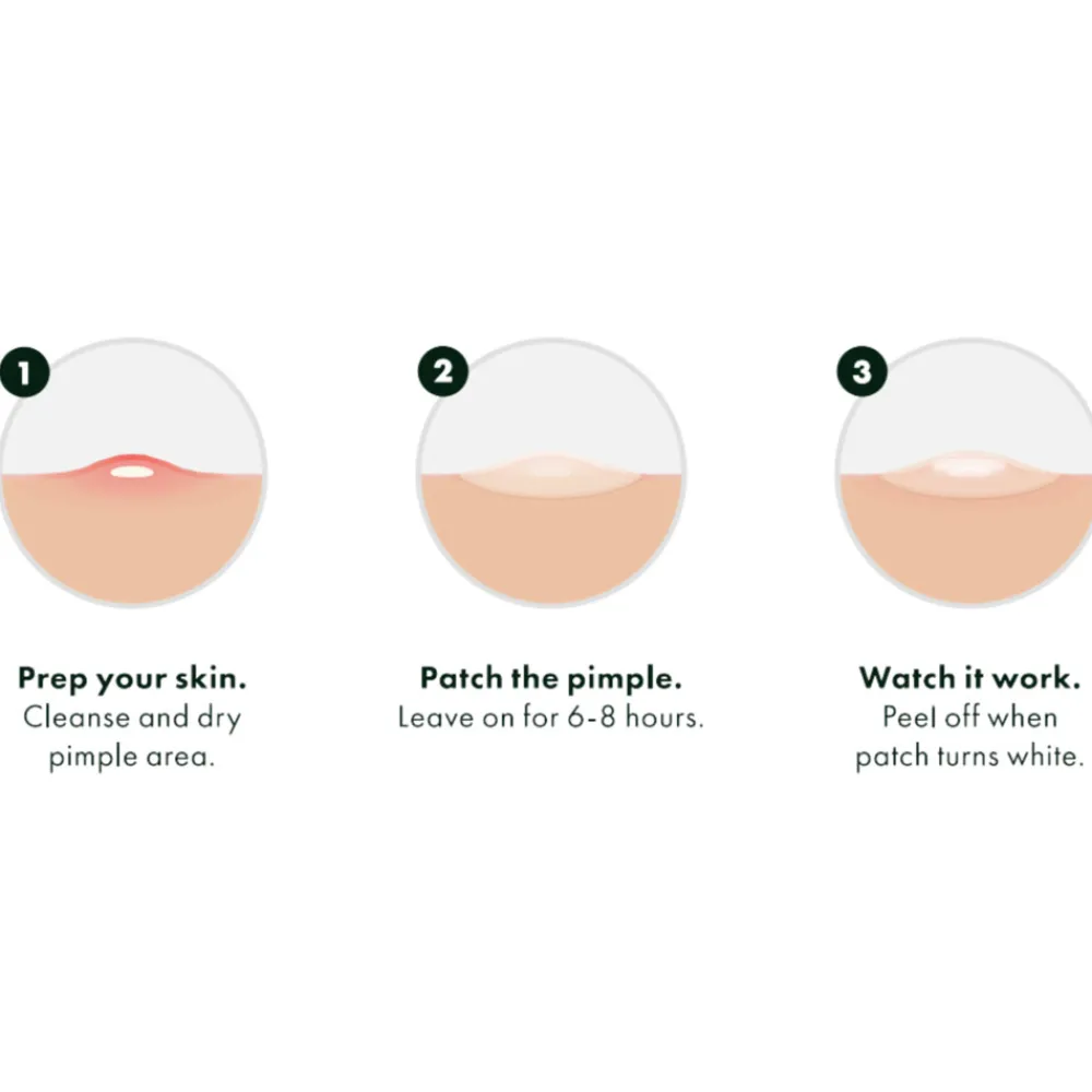 Reiniging<Hero Cosmetics Mighty Patch The Original 24 stuks