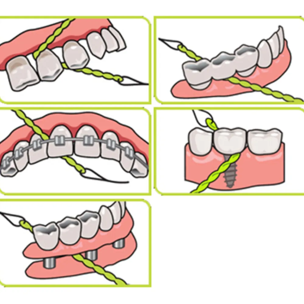 Discount X-Floss 30 stuks Flossen & Ragen