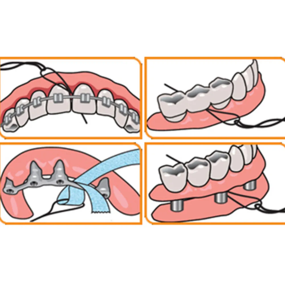 Discount X-Threaders 30 stuks Flossen & Ragen