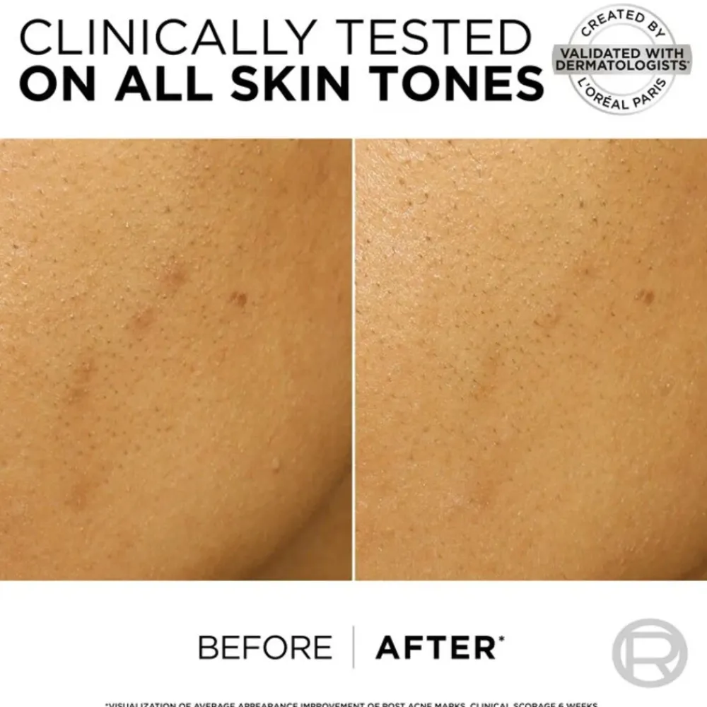 Serum<LOréal L'Oréal Dark Spot Exfoliant Snakepeel Bright Reveal 25 ml