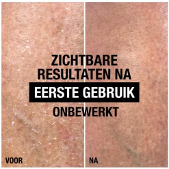 Intense Repair Cica Body Balm 250 ml^Neutrogena Outlet