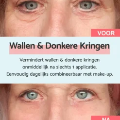Oogcrème<Remescar Oogcrème Wallen en Donkere Kringen 8 ml