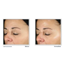 Best Multi Correxion Revive + Glow Daily Serum 30 ml Serum