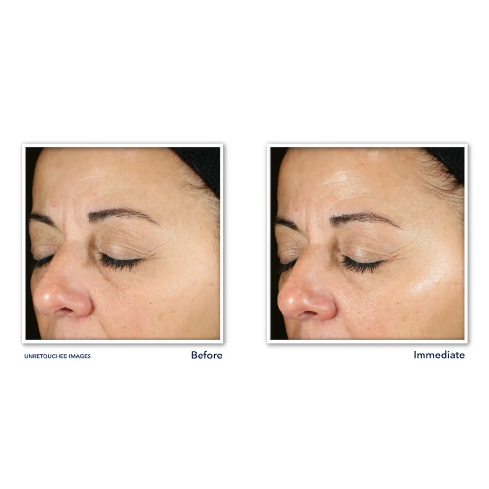 Best Multi Correxion Revive + Glow Daily Serum 30 ml Serum