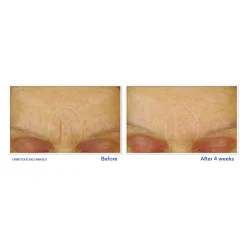 Retinol Correxion Gezichtscrème Smoothing Max Hydration 50 ml^RoC Clearance