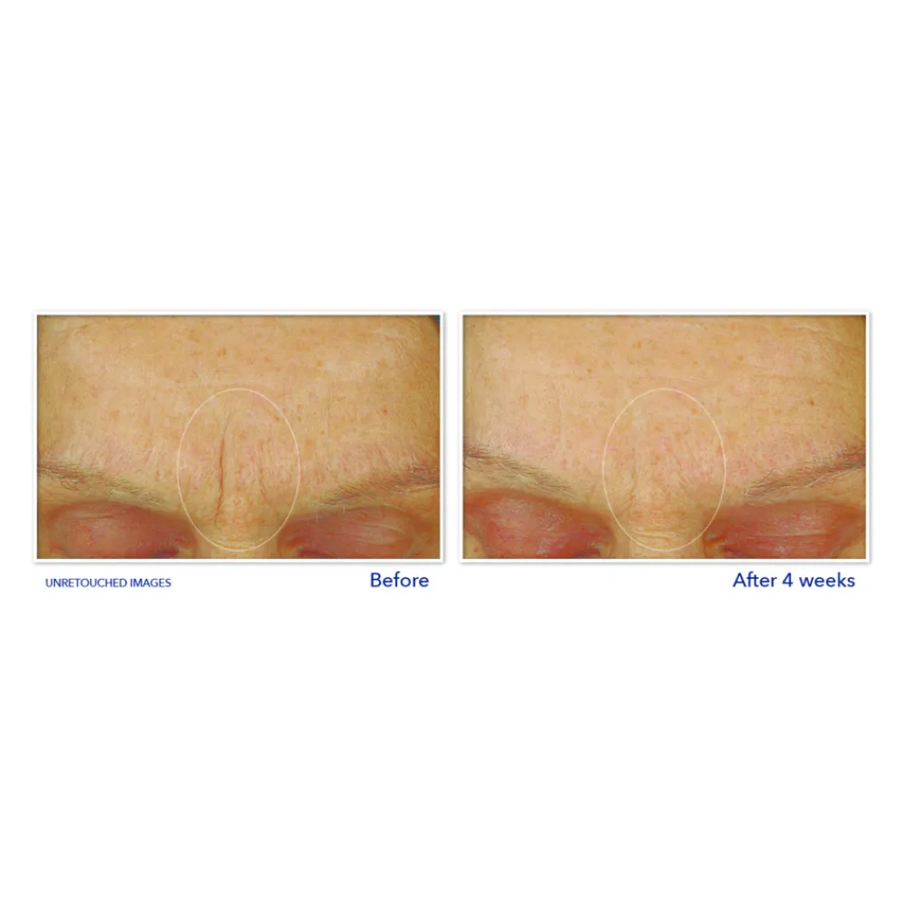 Retinol Correxion Gezichtscrème Smoothing Max Hydration 50 ml^RoC Clearance