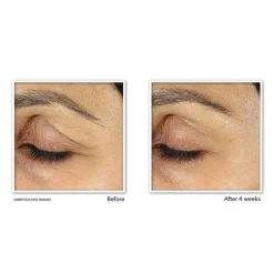 Online Retinol Correxion Line Smoothing Oogcrème 15 ml Oogcrème