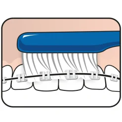 Tandenborstels<TePe Implantaat en Orthodontieborstel