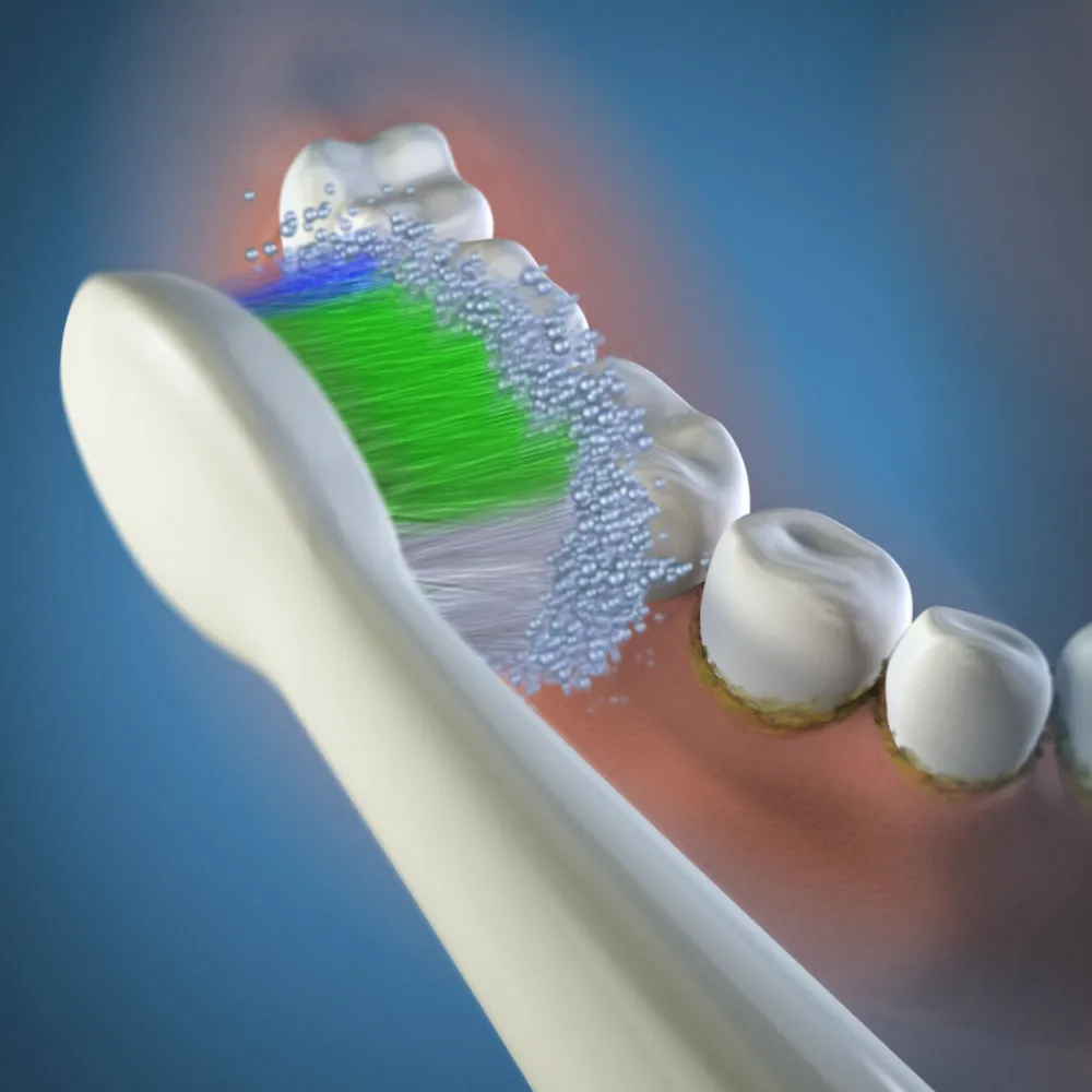 Flossen & Ragen|Tandenborstels<Waterpik Opzetborstels Compact Sensonic Small voor SR1000 en SR3000 3 stuks