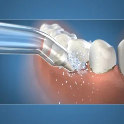 Pik Pocket Tips PP-100E 2 stuks^Waterpik Discount