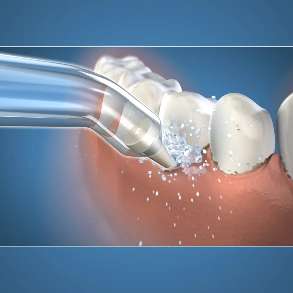 Pik Pocket Tips PP-100E 2 stuks^Waterpik Discount