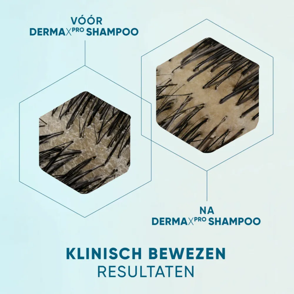 6x Anti-roos Shampoo DERMAxPRO Kalmeert 250 ml^Head & Shoulders Outlet