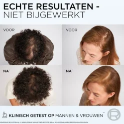 Online 6x L'Oréal Elvive Fiber Booster Anti-Haaruitval Shampoo 200 ml Shampoo