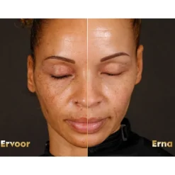 Hot 3x Luminous 630 Dagcrème Anti-Spot SPF 50 40 ml Dag- & Nachtcrème