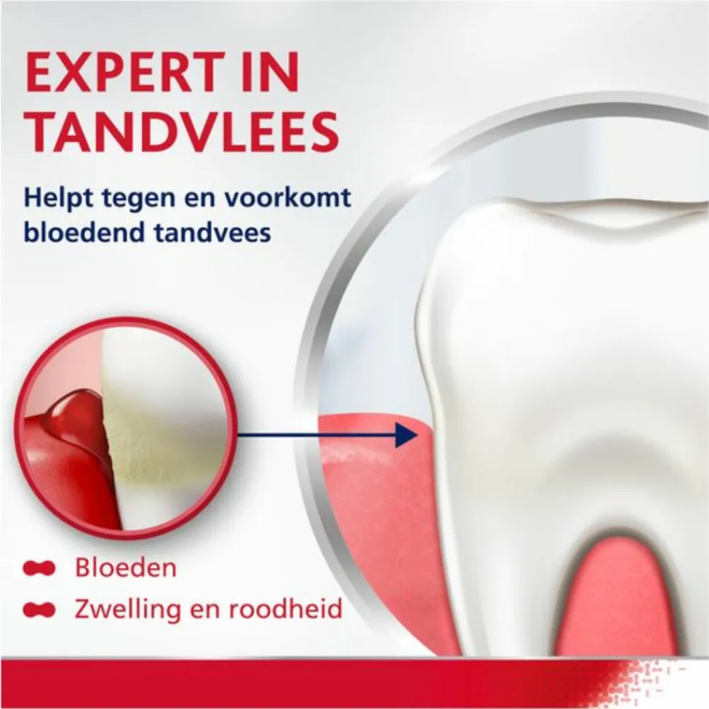 6x Complete Protection Extra Fresh tegen Bloeden Tandvlees 75 ml^Parodontax Online