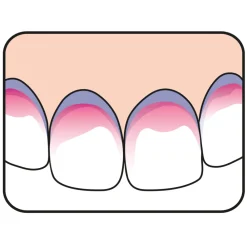 Best 5x PlaqSearch 10 tabletten Specialistische Mondverzorging