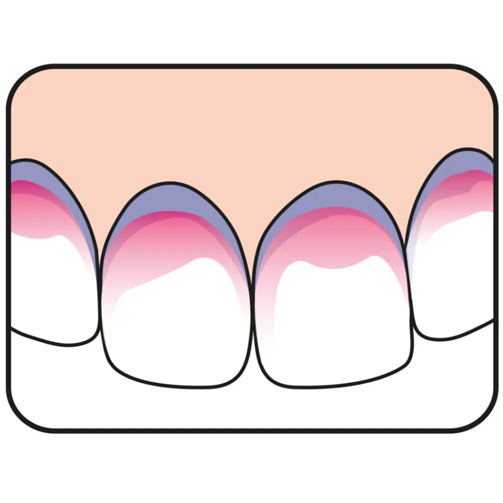 Best 5x PlaqSearch 10 tabletten Specialistische Mondverzorging